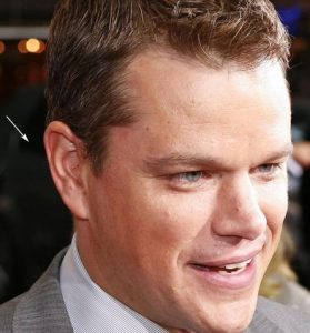 matt-damon-ear