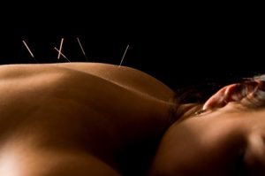 dreamstime_5221550needles-in-back