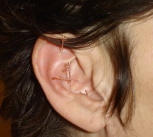 ear-needles