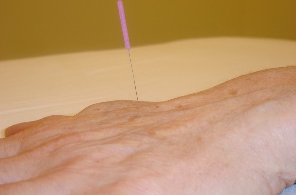 Paula Abdul Uses Acupuncture For Pain Relief