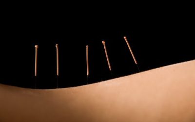 The Benefits Of Acupuncture For Cancer Patients