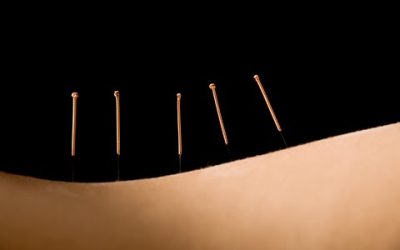 More of Dr. Oz’s Thought’s on Acupuncture