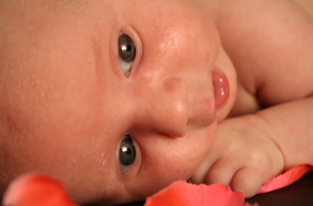 New Research~Acupuncture Is  Effective For Turning Breech Babies