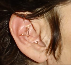 ear-needles