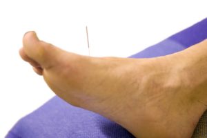 dreamstime_5445743foot-needle