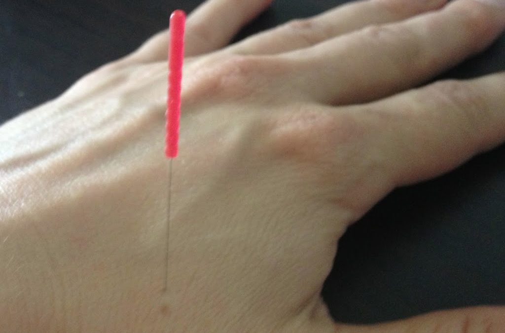 Ling Gu: An Amazing Acupuncture Point