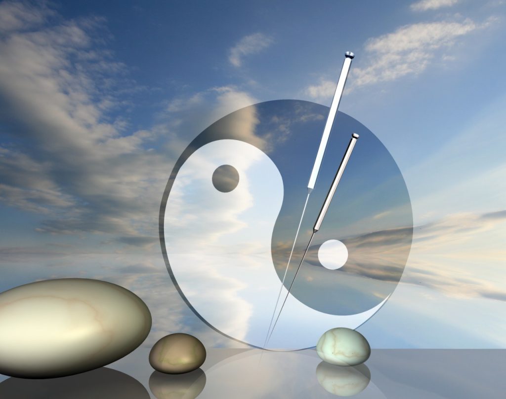 Acupuncture-Pain-Relief-Chicago