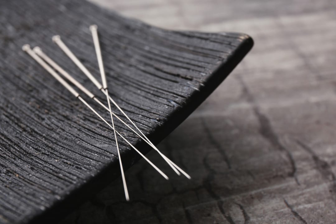 Acupuncture Treatment by Chicago Acupuncture Jennifer Dubowsky