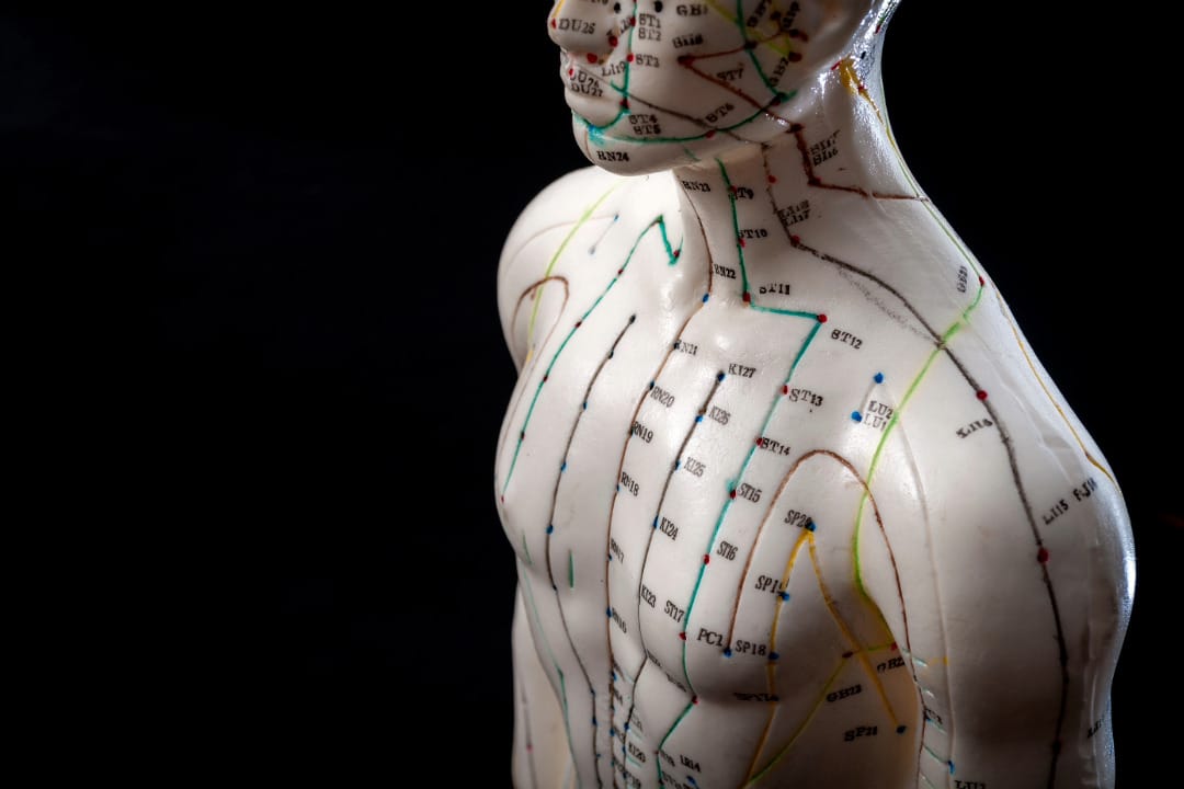 Chinese Medicine Treatments by Chicago Acupuncture Jennifer Dubowsky