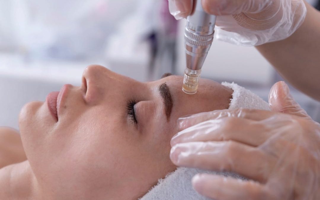 New Micro Needling Research