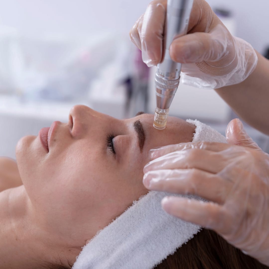 Microneedling Service Offered By Jennifer Dubowsky Chicago Acupuncturist